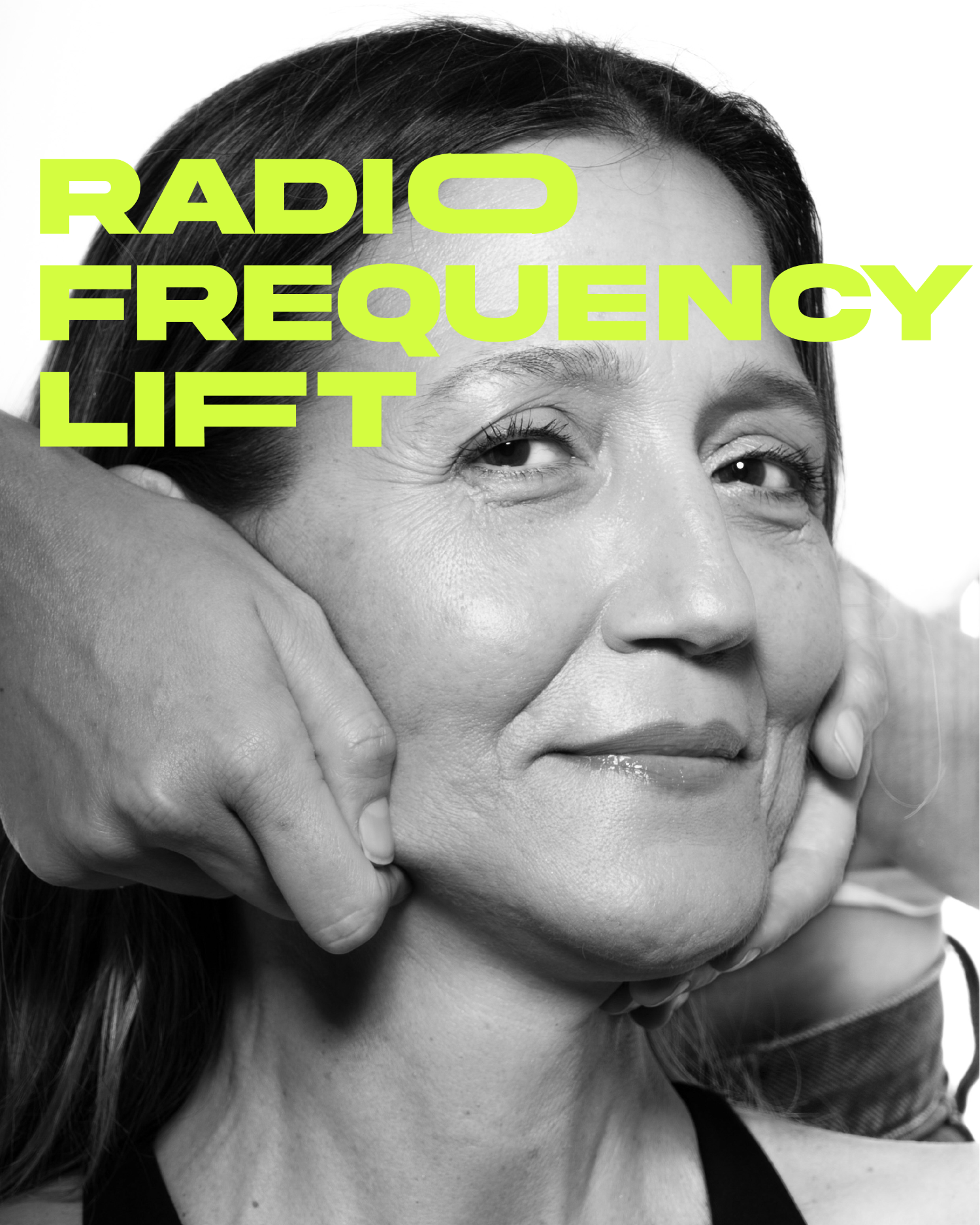 RADIO FREQUENCY LIFT – Work Your Face